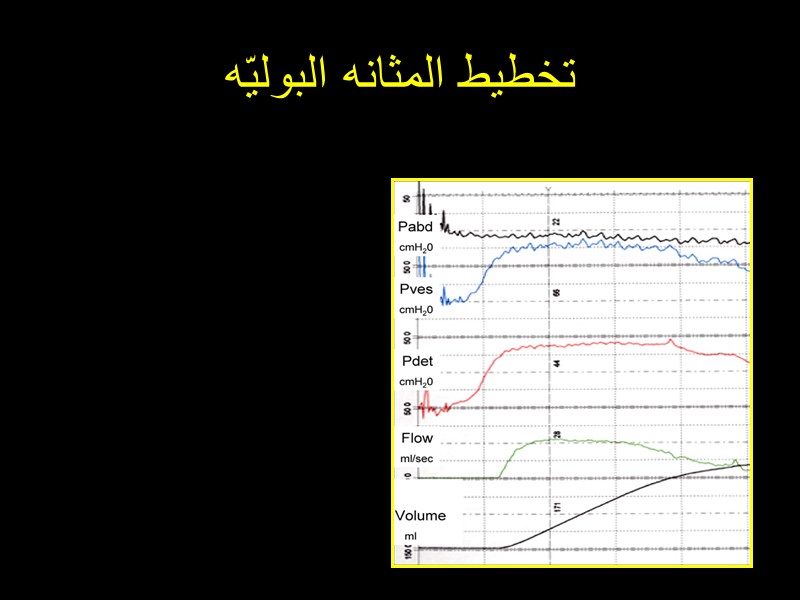 تخطيط المثانه البوليّه